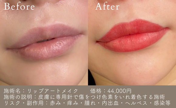 イメージ画像